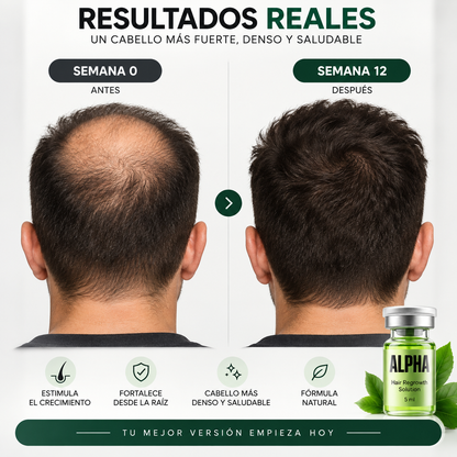 Alpha™ – Sistema de Regeneración Capilar